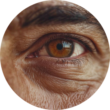 DARK CIRCLES